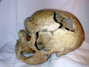 La Chapelle-aux-Saints 1, Homo neanderthalensis