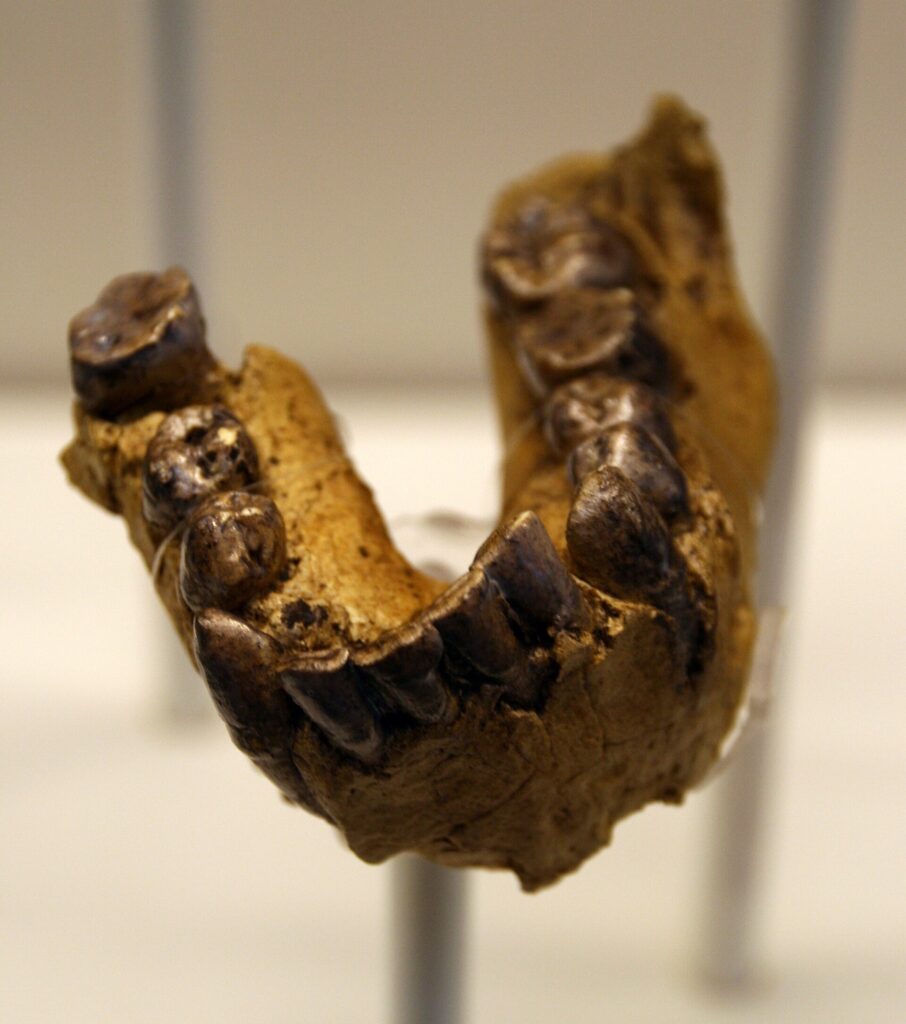 Moulage de la mandibule OH 7