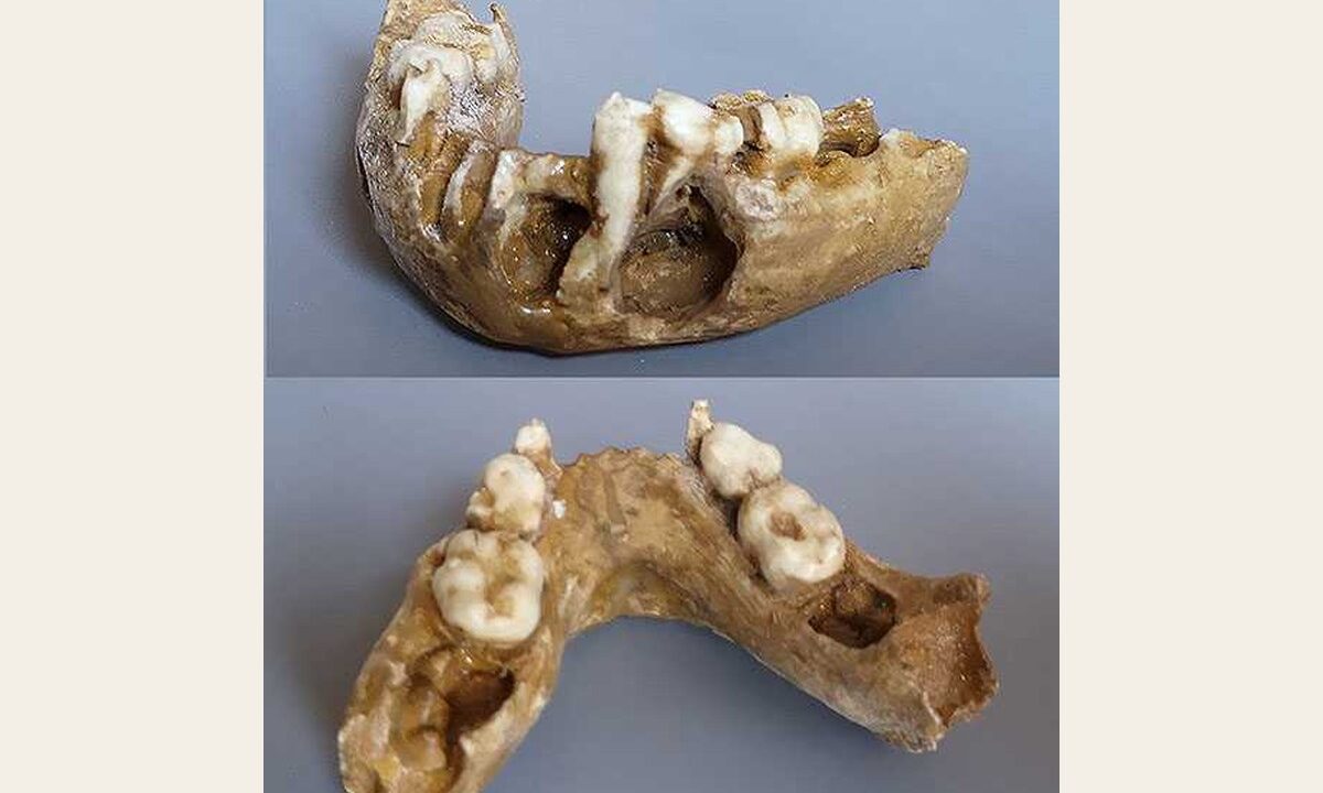 Moulage : mandibule inférieur jeune Paranthropus boisei