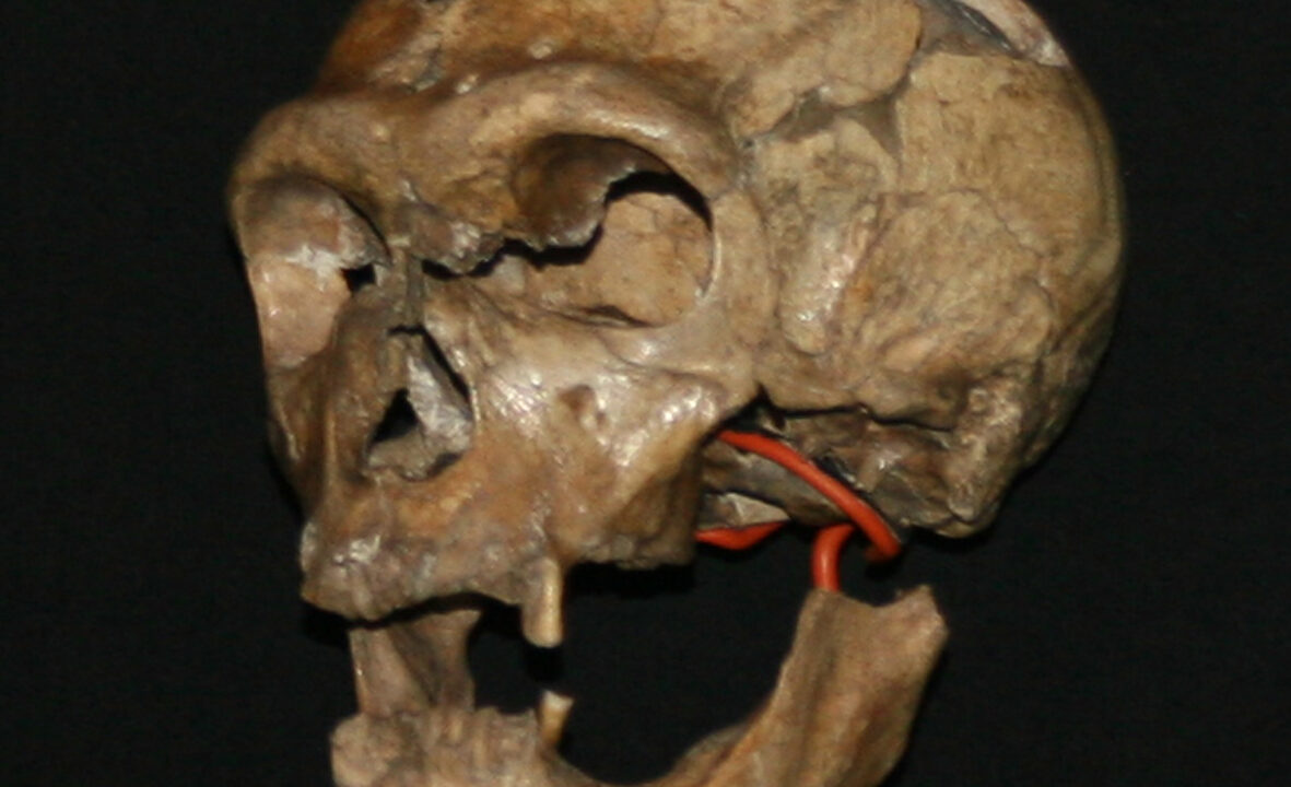 Le crâne du Néandertalien de La Chapelle-aux-Saints, mâchoire inférieure presque dépourvue de dents