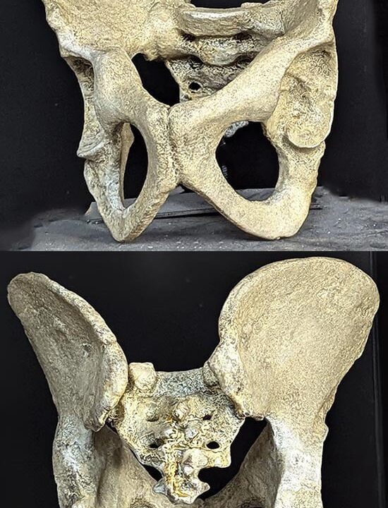 Moulage : bassin homo ergaster "Turkana Boy"