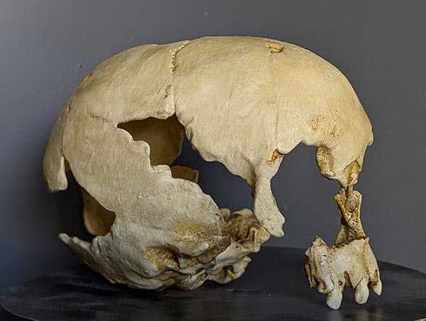 Moulage : crâne enfant Neandertal Engis 2