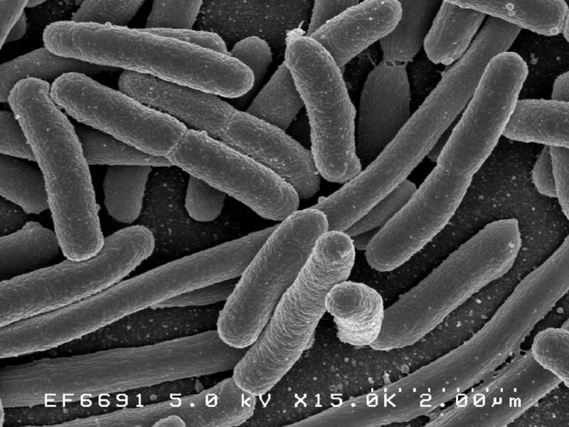 Bactéries intestinales (colibacilles) au microscope électronique